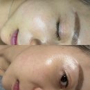 왕지3길 | 순천 피부관리 '아름온 에스테틱' 멜라 컨트롤 잡티 관리받고 온 솔직후기