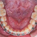 서울아산플란트치과의원 이미지