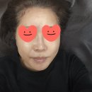 제니바의원 네이버블로그