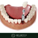 서울미니플란트치과의원 이미지