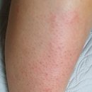 아띠의원 이미지