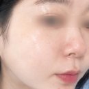 세라아쿠아 | 세라마이드 세럼 추천 속건조 잡아준 테라큐티스 아쿠아세라 수분세럼 후기