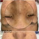 아임스킨