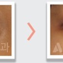 앤써성형외과의원 이미지