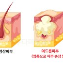 진성레이져 이미지