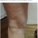 아나파적맥통증의원 Daum카페