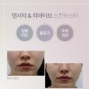 리바이브 디자인
