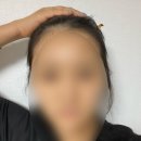 사유헤어 | 강서 두피문신 헤어라인문신 추천 후기[스튜디오 사유]