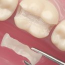 이룸 치과기공소 이미지