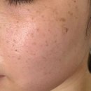 태극약국 | 태극제약 도미나크림 도미나스 비교 핵심 미백 비법