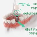 본기공소 이미지