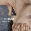 에네스뷰티 | 양정 피부관리 에네스뷰티 작은얼굴관리 후기