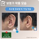 독일지멘스보청기 용인점 | 용인보청기 2026 정부지원보청기 라인업 및 가격 총정리<시그니아 독일보청기 편>