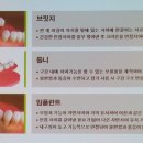 에스엘덴탈 네이버블로그