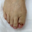 레푸스진주대안점