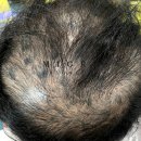 구미구미 | 구미 두피페인팅 후기 궁금하지 않나요?