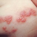 녹번한의원 이미지