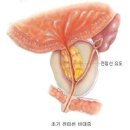 🍁No.291.중년남성들, 오줌줄기가 약해지는 이유? 이미지