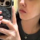 브이(V) | 코옆 붉은기 원인은? 강남역 코혈관레이저 엑셀브이(엑셀V) 내돈내산 후기