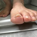 발건강 | 제주 내성발톱 케어 잘하는 곳 추천, 엄마 발 건강하게 만들어 드린 후기