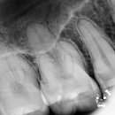 성복정원치과의원 이미지