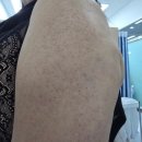 세븐일레븐 광주희망병원점 | 광주다이어트 주월복부지방분해주사 팔뚝제로팻주사후기 3주차