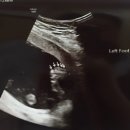 임신 22주 : 임신주수에 따른 검사 이미지