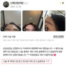 곽피부과의원 | 광주광대주사? 윤곽주사 후기로 결정하지 마세요
