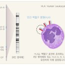 조직적합성항원(HLA)검사비용을 공개합니다. 이미지