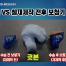 스타키보청기 용인난청센터 이미지
