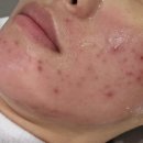 유니풀의원 이미지