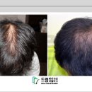 드림헤어라인의원 이미지