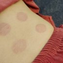 예온한의원 이미지