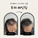 염색앤두피 화성향남점 | 향남 두피페인팅 후기｜가격 때문에 망설였던 고객님이 만족한 이유, 많이 받는 질문 TOP3