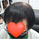 황계분 헤어샵 | 감쪽같이 감춰주는 김호증모 수제 부분가발♡♡ (헤어피스, 수제가발, 부분가발, 대구피스, 탈모초기...