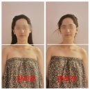 보라매온누리약국 | 보라매피부관리 행복에스테틱, 웨딩케어 비대칭 고민 사라진 후기