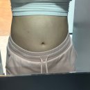 심바따 | [지방파괴술] 뱃살 빨리빼는 법을 알려드릴게요:) 복부 셀룰리스 3회차 후기