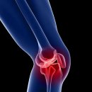 에이앤프리햅 이미지