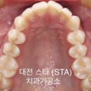 스타치과기공소 이미지