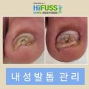 하이푸스 네일조아 응암점
