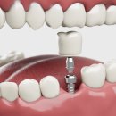 서울라미플란트치과교정과치과의원 이미지