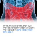 질병 "장염 Gastroenteritis" 이미지