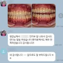 샘치과기공소 네이버블로그