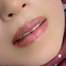 린아카데미 | 목포 입술반영구 잘하는곳｜린뷰티아카데미 어두운 입술톤 개선 후기