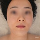 노란케어 119 | 숨어있던 V라인 찾기 의정부 씨앤제이뷰티 윤곽 경락 리얼 후기