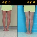 후메디앙스 이미지