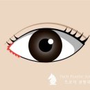 트로이성형외과 이미지