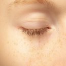 NO.1 자동차피부과 이미지