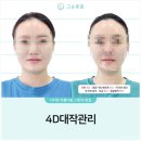 고운라인에스테틱 | 대구신부관리 추천 웨딩 전 얼굴라인 정리 만족했던 고운빛깔에스테틱대구점 후기