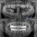연세강치과의원 이미지